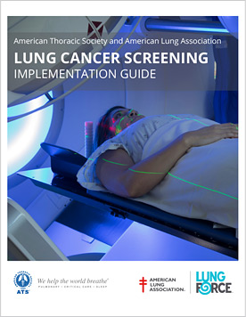 Lung Cancer Screening Implementation Guide